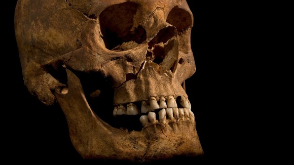 richard III skull 