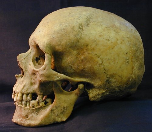 skull1